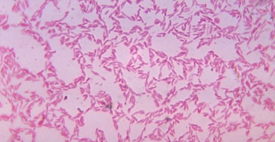 Les maladies sexuellement transmissibles (MST)